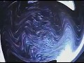 SÌNTOMA 3