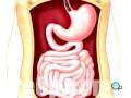 videos de Malpractice Medical GI Endoscopy - Upper GI 4