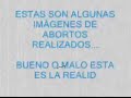 aborto