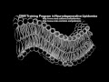 CIHR Training Program in Neurodegenerative Lipidomics: Ask me about Lipidomics - Dr Krista Lanctôt