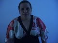 EFEITOS DA QUIMIOTERAPIA IV EFEITOS DA QUIMIOTERAPIA IV