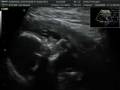 videos de yummy hand.