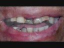 Cosmetic Dental Surgery: Beautiful results from Belgium