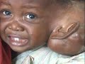 Surgeons Overseas
