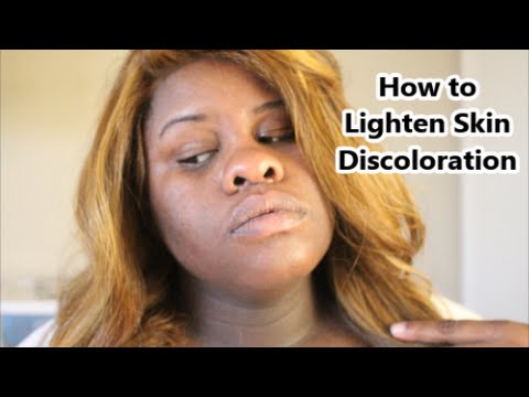 how to whiten dark neck