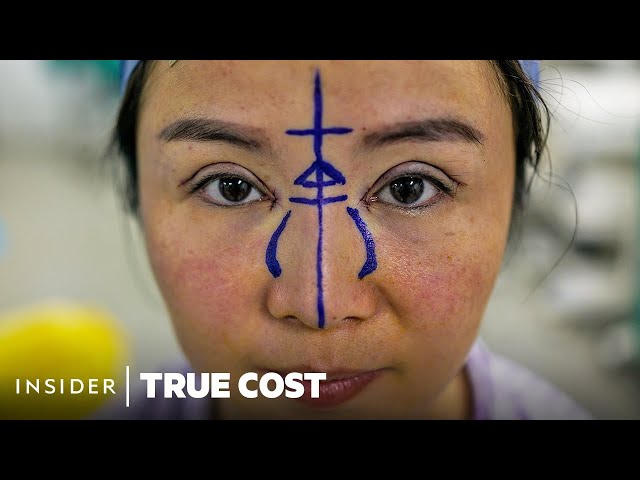 The Fake Doctors Behind Asia’s Cosmetic Surgery Boom | True Cost | Insider News