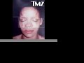 BREAKING NEWS: Rihanna bruised and beaten photos Leaked. TMZ BREAKING NEWS: Rihanna bruised and beaten photos Leaked. TMZ