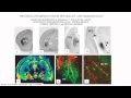 Marijuana: Negative Health Effects