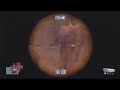 Team Fortress 2 - Gameplay Sniper Team Fortress 2 - Gameplay Sniper