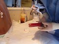 Thoracentesis Thoracentesis
