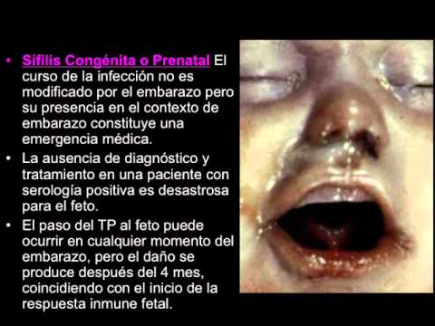 ENFERMEDADES DE TRANSMISIÓN SEXUAL (UNIVERSIDAD AUTÓNOMA DE TLAXCALA)