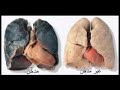 ضد التدخين ضد التدخين ضد التدخين ضد التدخين ضد التدخين