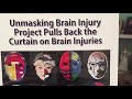 Unmasking Brain Injury - Windsor Star story