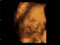 elizabeth and ian 4d baby scan