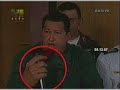 manos heridas de hugo chavez