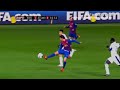 Травма Давида Вильи | Injury David Villa