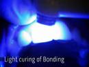 Dr. Timothy Huckabee Southlake Texas Quick Dental Makeover