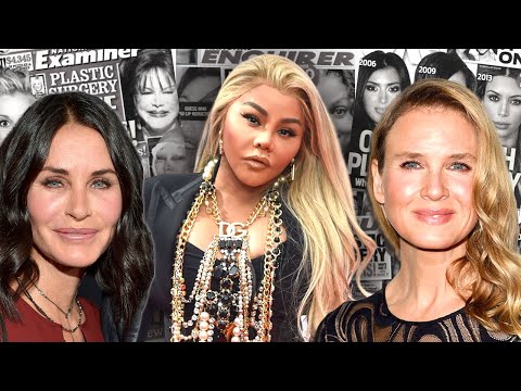 5 Celebrities Who "Ruined” Their Face with Plastic Surgery