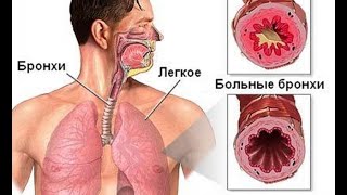 Народное лечение грибка в ушах