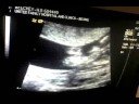 Baby Beechey - Sempurna