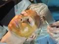 Tino Lerma - Dermaplaning