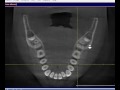 Axial view 3D CT
