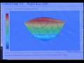 IQ Laser Vision, LASIK Eye Surgery Los Angeles