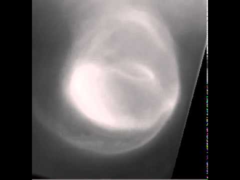 10 впечатляющих внеземных штормов и бурь. Непобедимые венерианские двойные вихри. Фото.