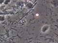 お口の中にいるトリコモナスです。有害な微生物です。他の細菌を食べています。女性の膣にいる微生物なので、性行為を介して感染したと思われます。歯周病菌も多い悪い細菌叢です。