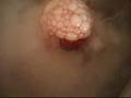 Bloody Dry Ice - Carboglace Sanglante