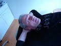 Acupuncture as treatment of chemotherapy induced neuropathy  Constipation Acupuncture