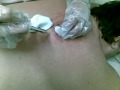 a cirurgia parte 2.mp4