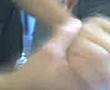 kinesioterapia