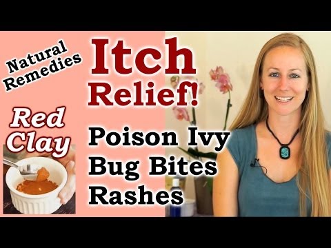 how to relieve itchy poison ivy