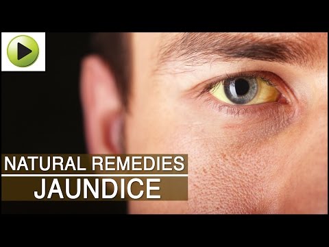 how to treat jaundice