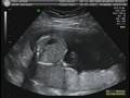 videos de Baby Midkiff 2 of 5
