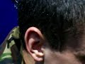 SGT Osbourne blister pain