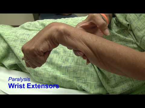 how to relieve radial nerve pain