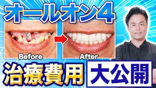 オールオン4の治療費用を解説!実際にかかる費用とは?