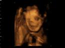 Window to the womb 4d baby scan of amy and donald Window to the womb 4d baby scan of amy and donald