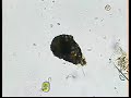 DIFFLUGIA TECAMEBA