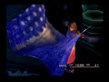 Final Fantasy X Live Single-Segment Attempt (select parts 10)
