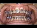Finishing Bends_Example Case 2 Part 2 Finishing Bends_Example Case 2 Part 2