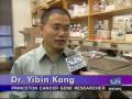Breast Cancer Gene - NJN News Healthwatch Report