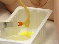 Foley-catheter-inser