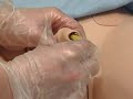 Foley-catheter-inser