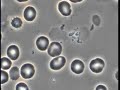 Erythrocytic Parasites