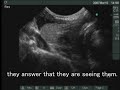 An ultrasound image of esophageal intubation