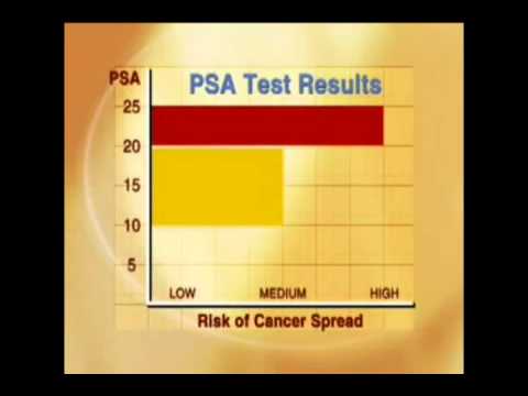 how to test for vitamin e