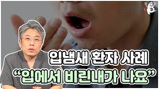 입에서 비린내가 나는 환자